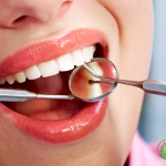 Woman smiling with dental tools in mouth during hygiene checkup, showing clean and healthy white teeth