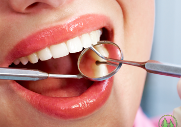 Woman smiling with dental tools in mouth during hygiene checkup, showing clean and healthy white teeth