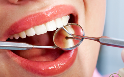 Woman smiling with dental tools in mouth during hygiene checkup, showing clean and healthy white teeth