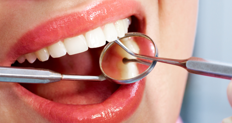 Woman smiling with dental tools in mouth during hygiene checkup, showing clean and healthy white teeth