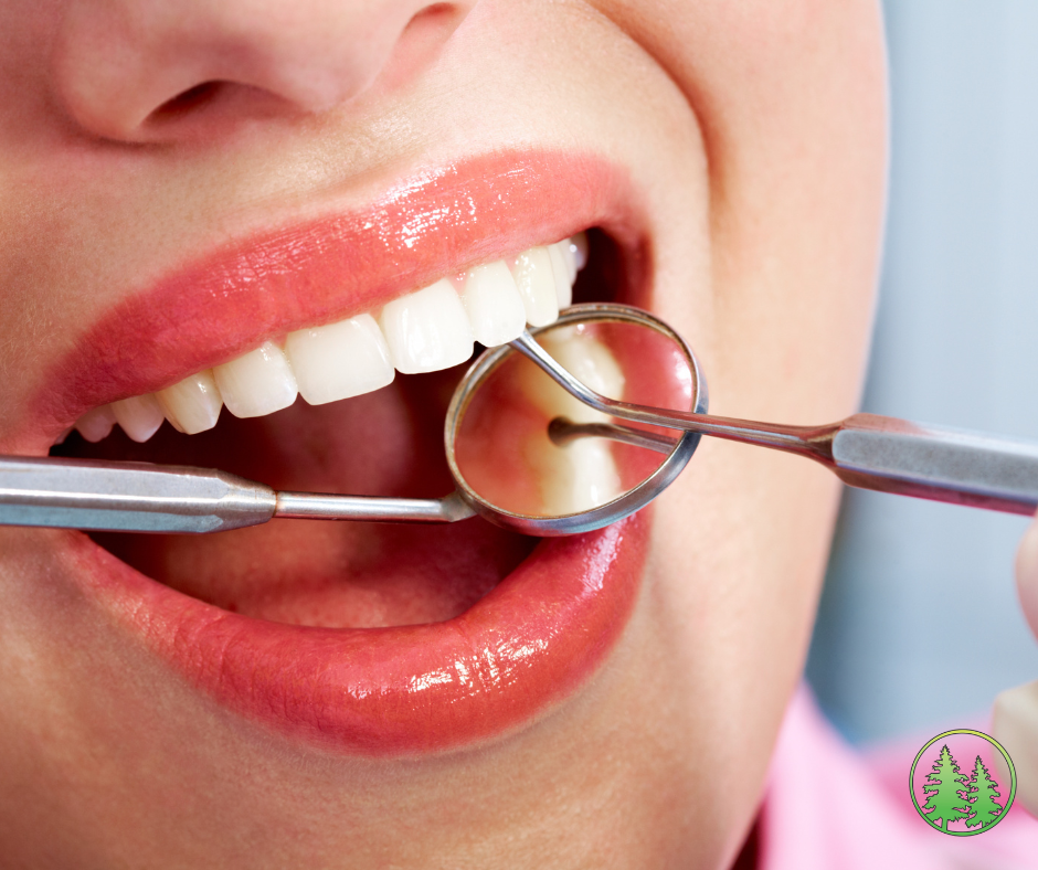 Woman smiling with dental tools in mouth during hygiene checkup, showing clean and healthy white teeth